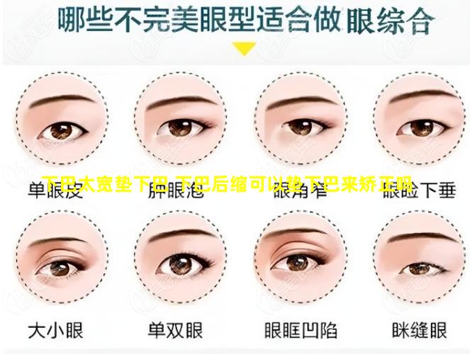 下巴太宽垫下巴 下巴后缩可以垫下巴来矫正吗